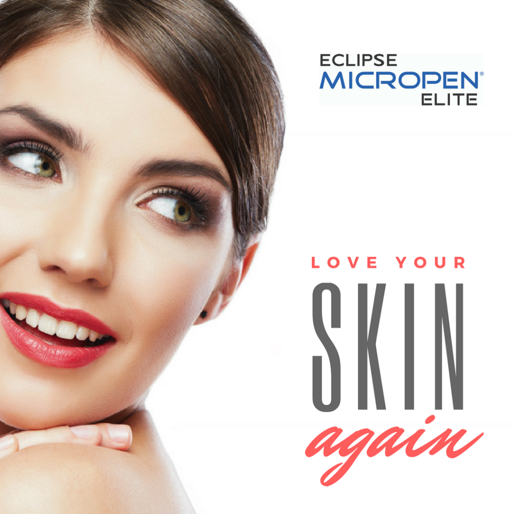 Microneedling - Golden Pulse Cosmetic Center Richmond Hill and Bradford