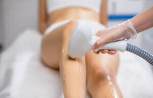 Laser Hair Removal in Markham
