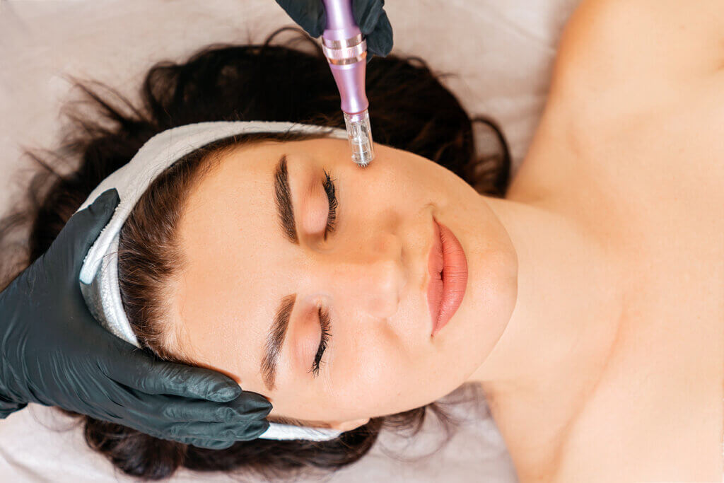 microneedling with PRP