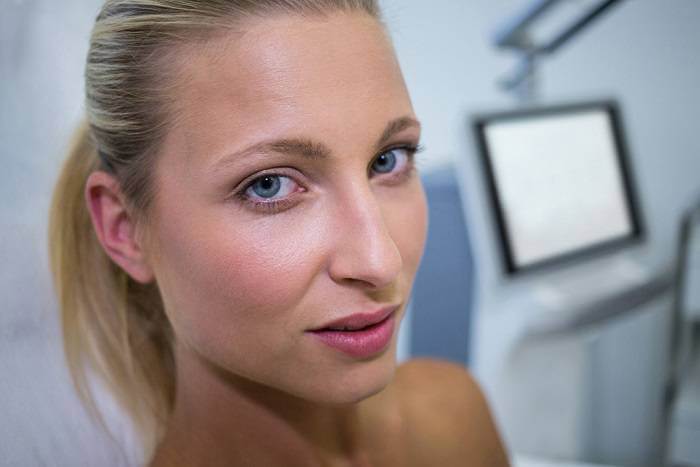 Skin redness after microneedling