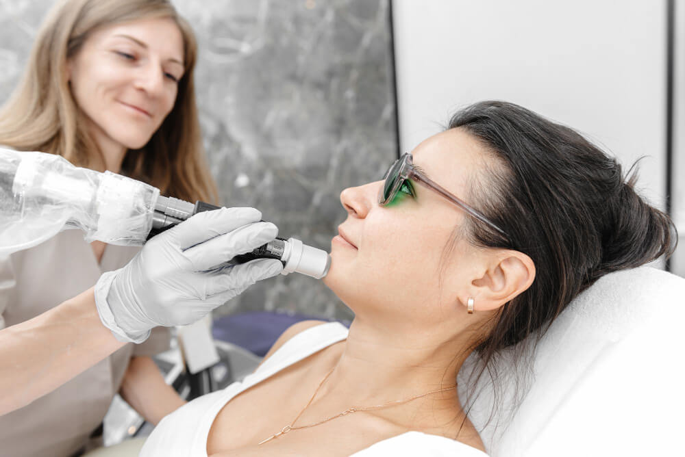 Laser Treatment for Facial Hair Removal