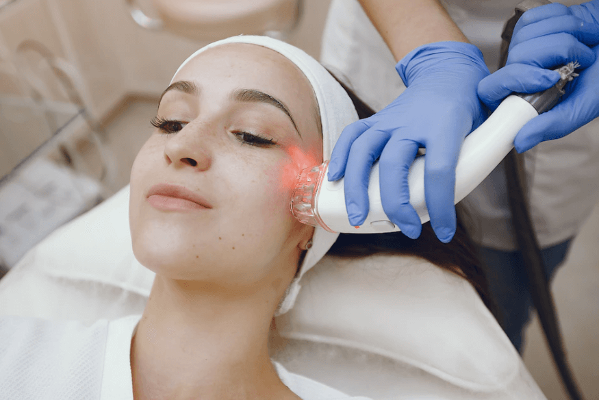 Does Laser Hair Removal cause wrinkles?