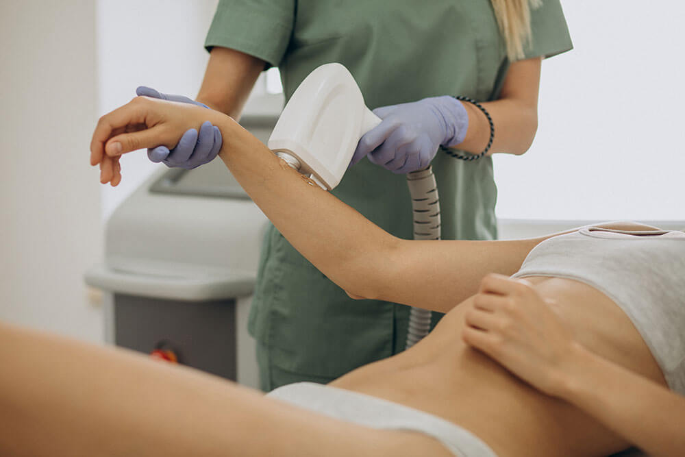 What is the best laser for hair removal?