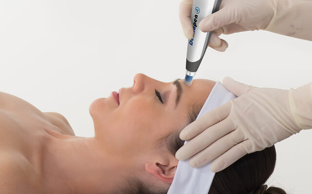 Microneedling Cost in Toronto: How Much Should You Expect to Pay?