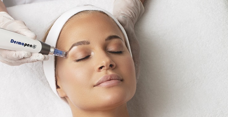 Microneedling Cost in Toronto: How Much Should You Expect to Pay?