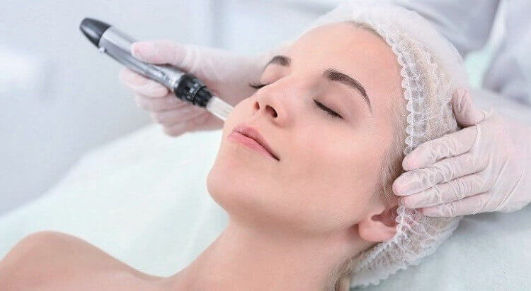 Microneedling Cost in Toronto: How Much Should You Expect to Pay?