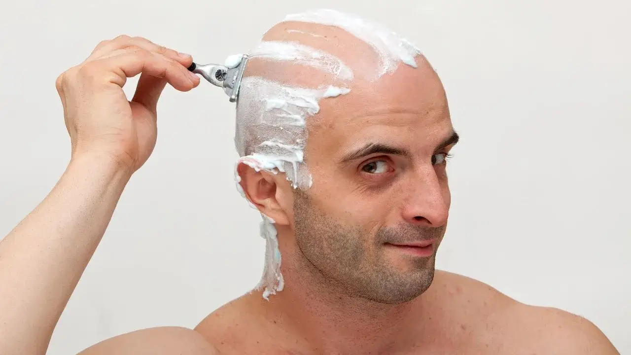 Do I Have to Shave My Head Before SMP?