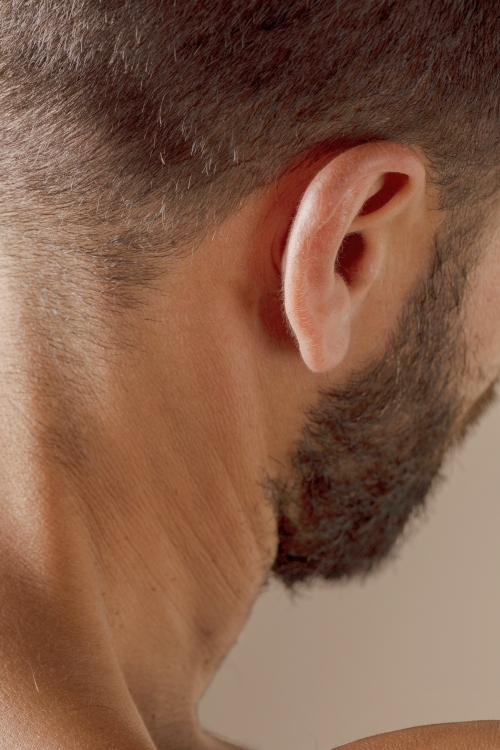 Hairy male back neck before laser hair removal treatment