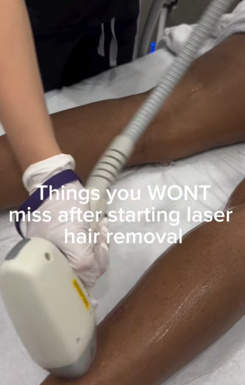 Before and after results of laser hair removal showing smooth, hair-free skin and reduced hair growth over time