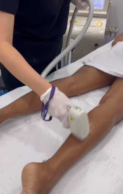 Client receiving laser hair removal consultation and test session to assess skin type and treatment suitability.