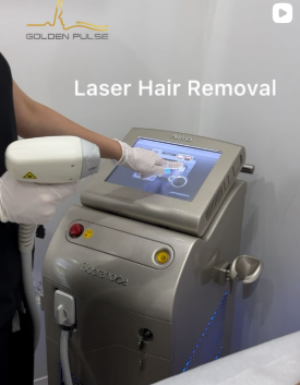 Laser Hair Removal In Richmond Hill