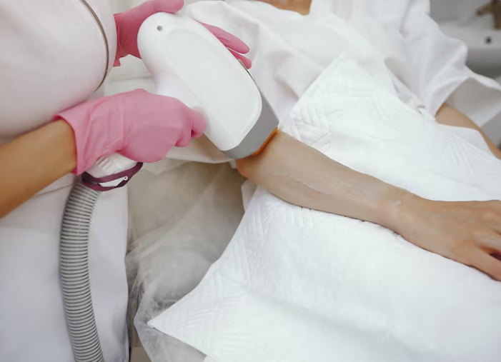 underarm laser hair removal