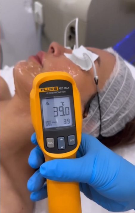 All skin type safe laser hair removal