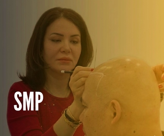 Hairline Restoration by SMP